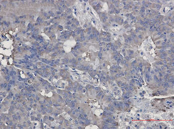 Hsp90 beta Rabbit mAb Antibody