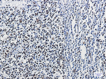hnRNP M Rabbit mAb Antibody