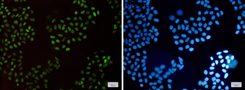 HLTF Rabbit mAb Antibody