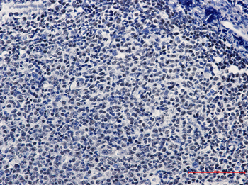 KAT1 Rabbit mAb Antibody