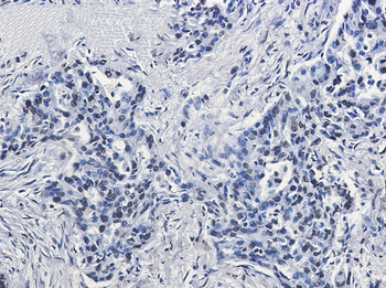 Histone H2A.X Rabbit mAb Antibody