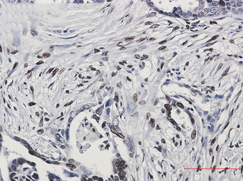 Histone H1.0 Rabbit mAb Antibody