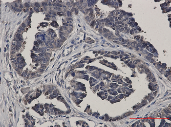 Glutathione Synthetase Rabbit mAb Antibody