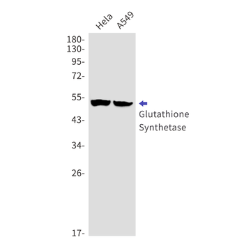 Glutathione Synthetase Rabbit mAb Antibody