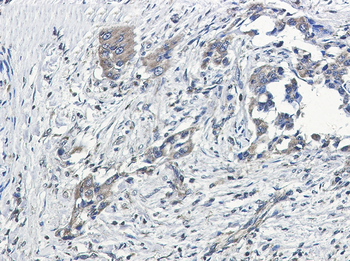 GNAI2 Rabbit mAb Antibody