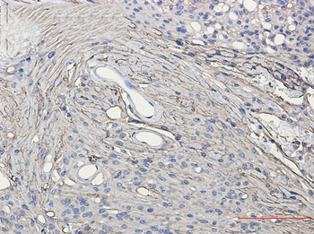 GAP43 Rabbit mAb Antibody