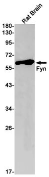 FYN Rabbit mAb Antibody