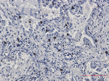 FLI1 Rabbit Monoclonal Antibody