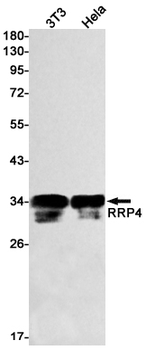 RRP4 Rabbit mAb Antibody
