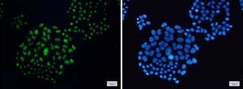 EWSR1 Rabbit mAb Antibody
