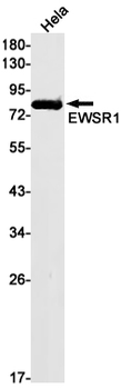 EWSR1 Rabbit mAb Antibody