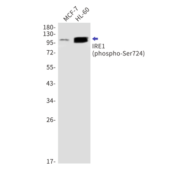 IRE1 (Phospho-Ser724) Rabbit mAb Antibody