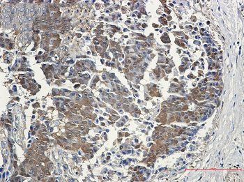 4E BP1 Rabbit mAb Antibody