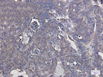 eIF3B Rabbit Monoclonal Antibody