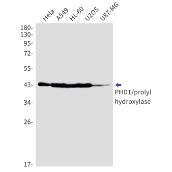 PHD1 Rabbit mAb Antibody