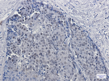 DKC1 Rabbit mAb Antibody