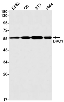 DKC1 Rabbit mAb Antibody