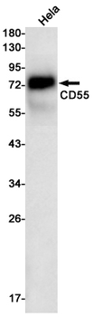 CD55 Rabbit mAb Antibody