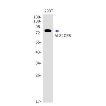 ALS2CR8 Rabbit mAb Antibody