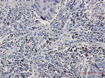 BNIP3L Rabbit mAb Antibody