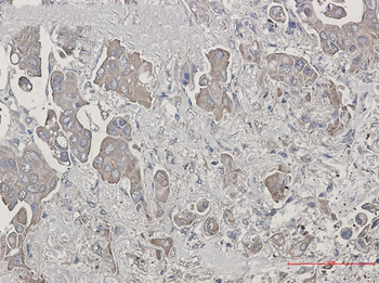 Bid Rabbit mAb Antibody