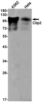 Ctip2 Rabbit mAb Antibody