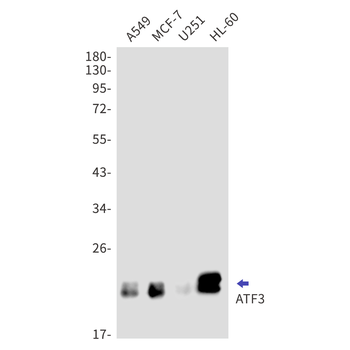 ATF3 Rabbit mAb Antibody