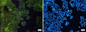 AdSS 2 Rabbit mAb Antibody