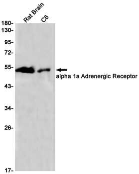 alpha 1a Adrenergic Receptor Rabbit mAb Antibody
