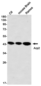 Actin Related Protein 2 Rabbit mAb Antibody