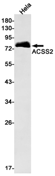 ACSS2 Rabbit mAb Antibody
