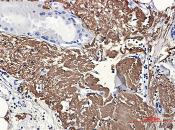 Aconitase 2 Rabbit mAb Antibody