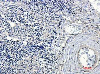 14 3 3 alpha/beta Rabbit mAb Antibody
