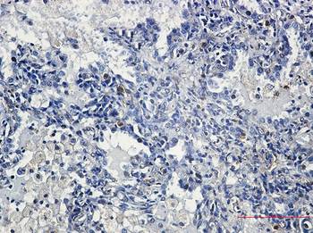 YB1 Rabbit mAb Antibody