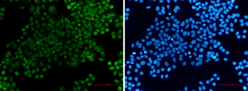 XRCC1 Rabbit mAb Antibody
