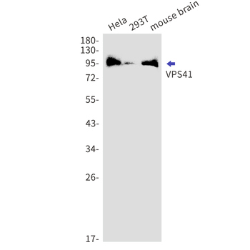 VPS41 Rabbit mAb Antibody