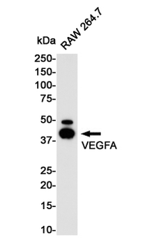 VEGFA Rabbit mAb Antibody