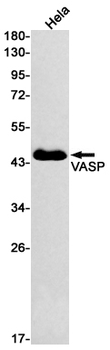VASP Rabbit mAb Antibody