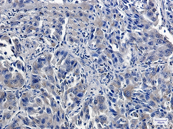 USP7 Rabbit Monoclonal Antibody