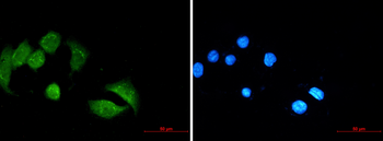 Ubiquitin Conjugation Factor E4 B Rabbit mAb Antibody