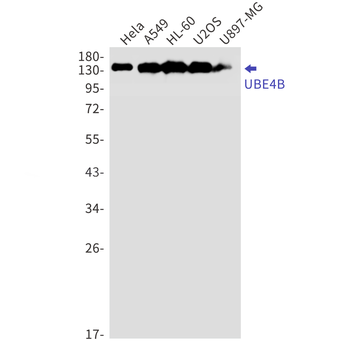 Ubiquitin Conjugation Factor E4 B Rabbit mAb Antibody
