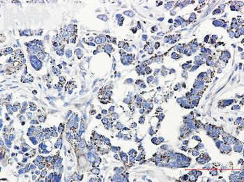 Thioredoxin Reductase 2 Rabbit mAb Antibody