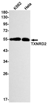Thioredoxin Reductase 2 Rabbit mAb