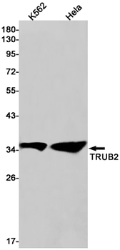 TRUB2 Rabbit mAb Antibody
