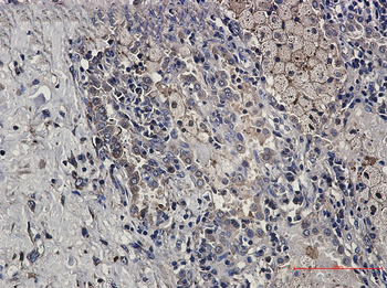 DcR2 Rabbit mAb Antibody