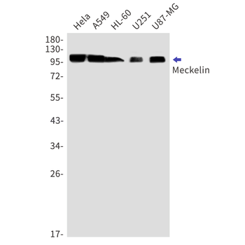 Meckelin Rabbit mAb
