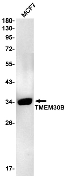 Transmembrane Protein 30B Rabbit mAb Antibody