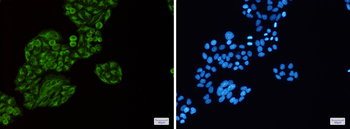 Tec Rabbit mAb Antibody