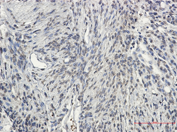 Synapsin 2 Rabbit mAb Antibody