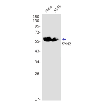 Synapsin 2 Rabbit mAb Antibody